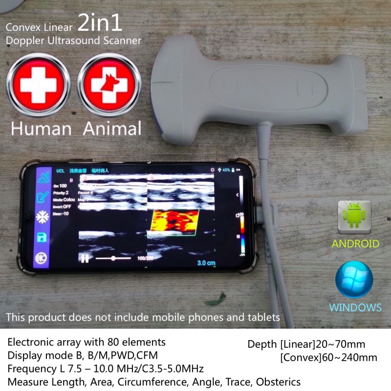 Wireless linear ultrasound scanner for human medicine